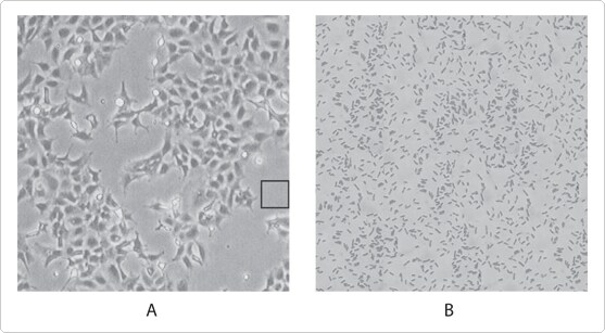 293 cells contaminated with E. coli Two panels with simulated phase contrast images of adherent 293 cells contaminated with E. coli