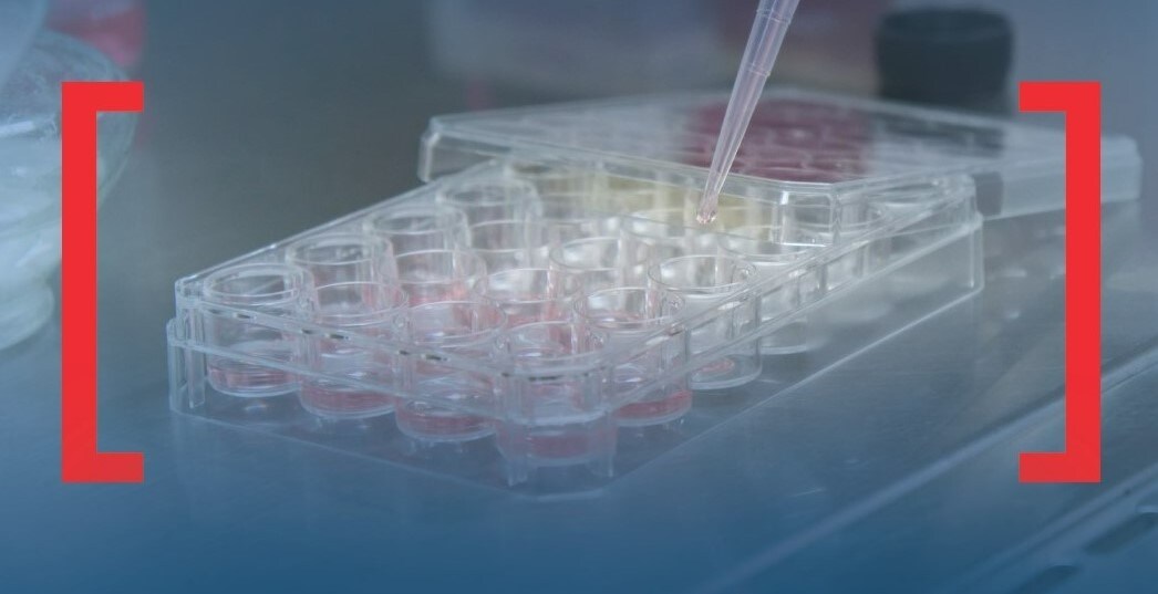 Transfection lab essentials Transfection lab essentials